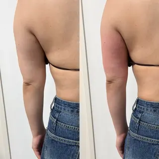 Miiju.所属・Miiju. 石巻市 脂肪冷却  鈴木のエステ・リラクイメージ