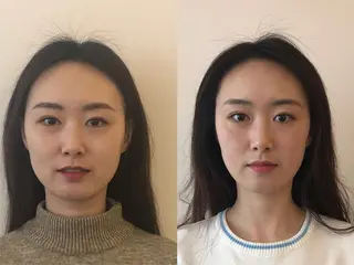 ロング 小顔矯正/美容整体 /骨盤矯正✨+Mi2のエステ・リラクイメージ