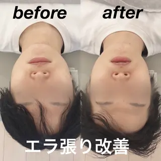 経堂鍼灸整体院 古木のエステ・リラクイメージ
