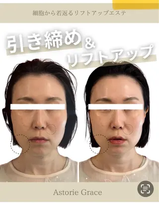 Astorie 相模大野エステのエステ・リラクイメージ
