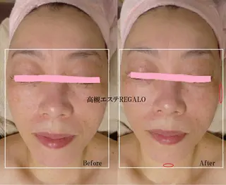 REGALO所属・矢野 さやかのエステ・リラクイメージ