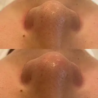 VERY VERY九条店所属・ベリーベリー🌹 九条店のエステ・リラクイメージ