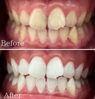 メンズ ホワイトニング専門店 WHITE天神店のエステ・リラクイメージ