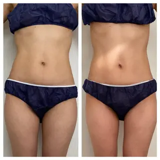 武藤 千裕のエステ・リラクイメージ