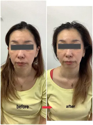 メディカルサロンドオフ所属・ハリサロンドオフ 美容鍼灸×小顔整体のエステ・リラクイメージ