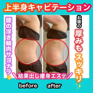 痩身/脱毛/ネイル HARUKAのエステ・リラクイメージ