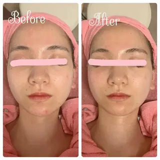 透明感の肌Lino malieのエステ・リラクイメージ