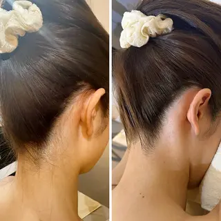 うなじ脱毛/美肌脱毛 LABELのエステ・リラクイメージ