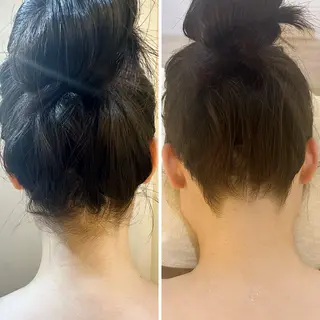 うなじ脱毛/美肌脱毛 LABELのエステ・リラクイメージ