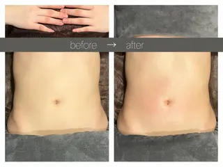 ☆痩身/小顔☆ 結果出します☆のエステ・リラクイメージ