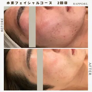 メンズ Rappore; 心斎橋　みずきのエステ・リラクイメージ