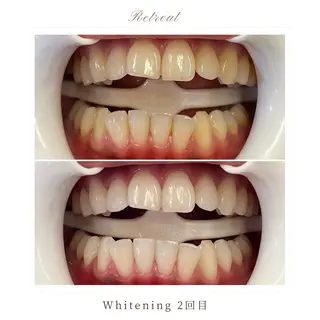 Retreatリトリート所属・歯科医院提携 Retreatのその他イメージ