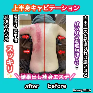 痩身/脱毛/ネイル HARUKAのエステ・リラクイメージ