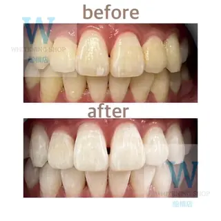 ホワイトニング ショップ船橋店のエステ・リラクイメージ