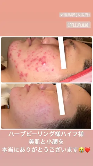 FLEUR大阪・整体 ・ハイフ・痩身・小顔のエステ・リラクイメージ