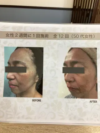 矢野 つかさのマツエク・マツパデザイン