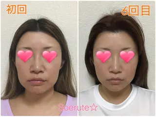Soerute☆ ソエルテ 井上みえのエステ・リラクイメージ
