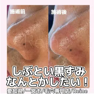 Reine BeautySalon所属・毛穴/シミ肝斑/脱毛 横山梨里のエステ・リラクイメージ
