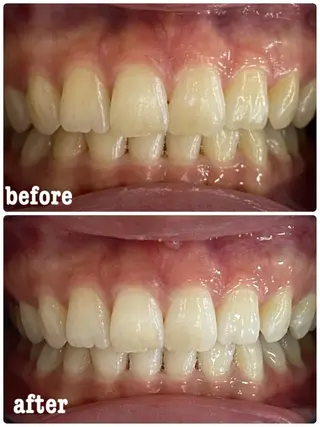 ホワイトニングサロン ラウレアのその他イメージ