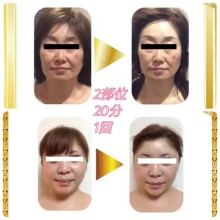 ミューズビューティー所属・山本 ゆりのエステ・リラクイメージ