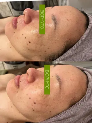 ☆痩身/小顔☆ 結果出します☆のエステ・リラクイメージ