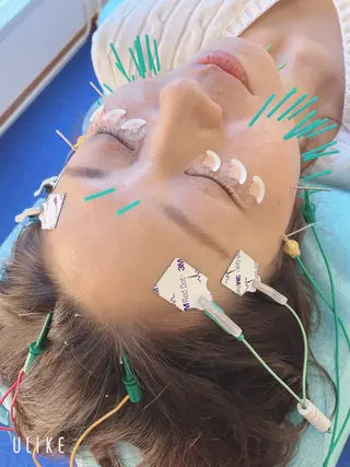 小顔美容鍼専門サロン 渋谷YZのエステ・リラクイメージ