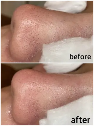 韓国肌管理 【毛穴専科】のエステ・リラクイメージ