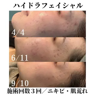 トータルビューティー サロンSalaのマツエク・マツパデザイン