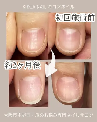 ネイル KIKOA NAIL キコアネイルのネイルデザイン