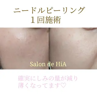 Salon de HiAのエステ・リラクイメージ