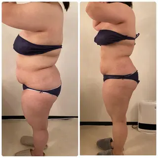 FLEUR大阪・整体 ・ハイフ・痩身・小顔のエステ・リラクイメージ