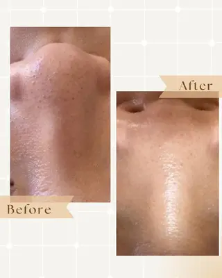薮 愛のエステ・リラクイメージ