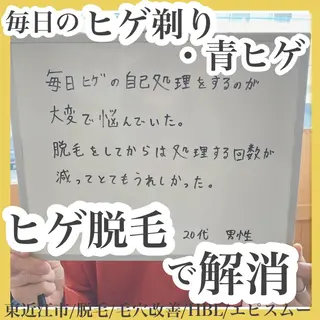 epismoo 脱毛/HBL/毛穴の眉毛・アイブロウイメージ