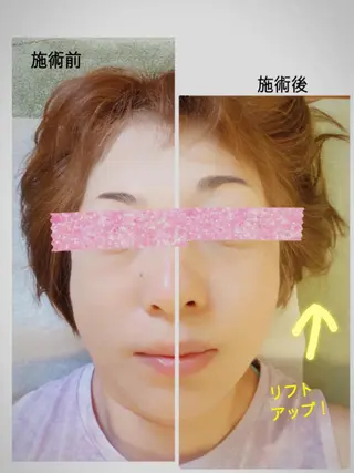 Anne’s happyBonesのエステ・リラクイメージ