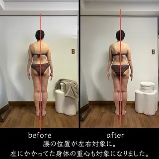 salon jiuu 巻き肩・肩こり・猫背のエステ・リラクイメージ