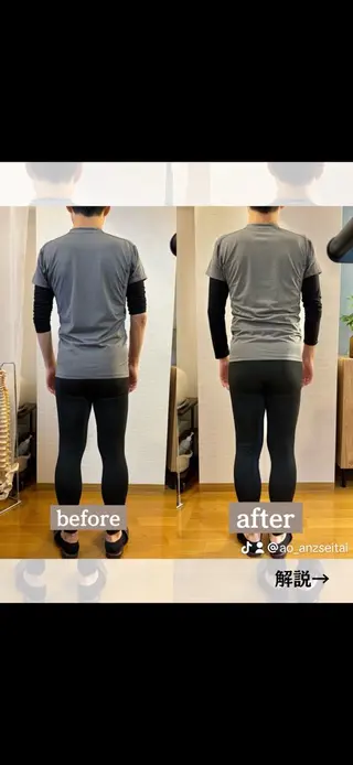 メンズ ANZ美容整体所属・美姿勢|痩身|目黒 ANZ-美容整体-のエステ・リラクイメージ