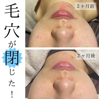 ハーブピーリング・毛穴ケア専門サロンSalon de LENA所属・ハーブピーリング 専門店/名古屋駅前店のエステ・リラクイメージ