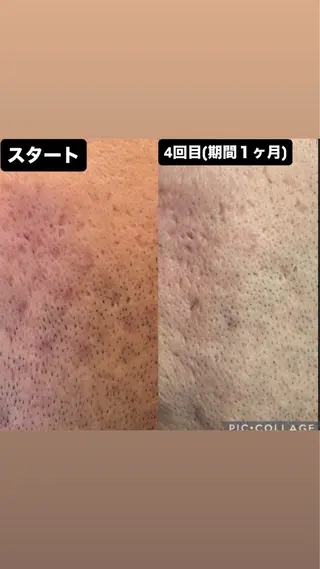 Bright所属・Brightブライト (エステ.リラク)のエステ・リラクイメージ