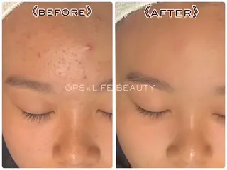 メンズ OPS×LIFE BEAUTY所属・OPS×LIFE BEAUTY/maiのエステ・リラクイメージ