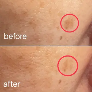 痛くないシミ取り 【荻窪】石橋のヘアスタイル