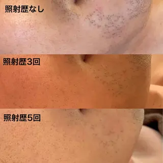 美肌コラーゲン脱毛SINCERITE【サンセリテ】所属・瀬野 のぞみのエステ・リラクイメージ
