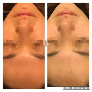 ミディアム カラー パーマ ヘアアレンジ メンズ キッズ ネイル マツエク・マツパ アニメ,Vオタク× 即効痩せエステサロンのエステ・リラクイメージ