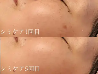シミたるみケア リラク リタ池尻大橋のエステ・リラクイメージ