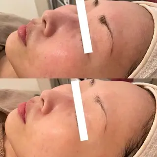 ✨美肌水光✨ アトリエリュバンのエステ・リラクイメージ