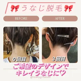 プライベートサロン宿り木所属・江坂@宿り木　脱毛＆ 耳ツボジュエリーのその他イメージ