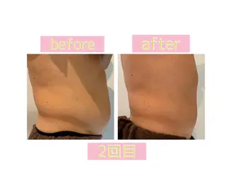 メンズ 癒し腸もみサロン シャユーム　ゆきなのエステ・リラクイメージ