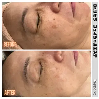 Rappore; 心斎橋　みずきのエステ・リラクイメージ