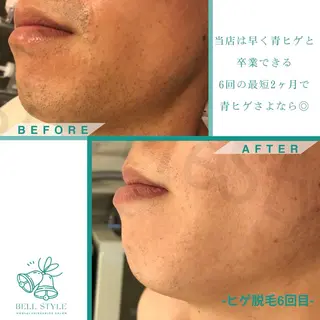 メンズ キッズ メンズ&レディース　Bell style所属・【脱毛・美肌専門】 bellstyleのエステ・リラクイメージ
