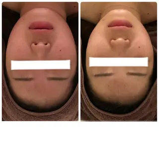 FLEUR大阪・美容 整体・痩身・小顔のエステ・リラクイメージ