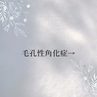 beauty CHOOSEのマツエク・マツパデザイン